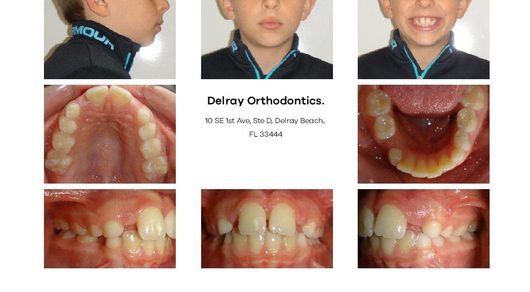 Delray Orthodontics Dental