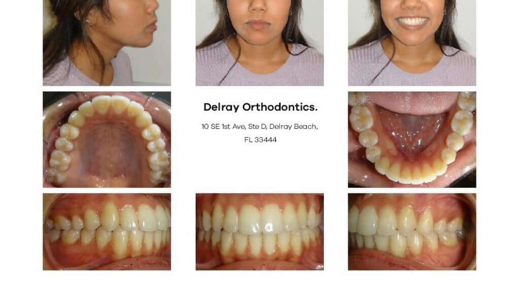 Delray Orthodontics Dental