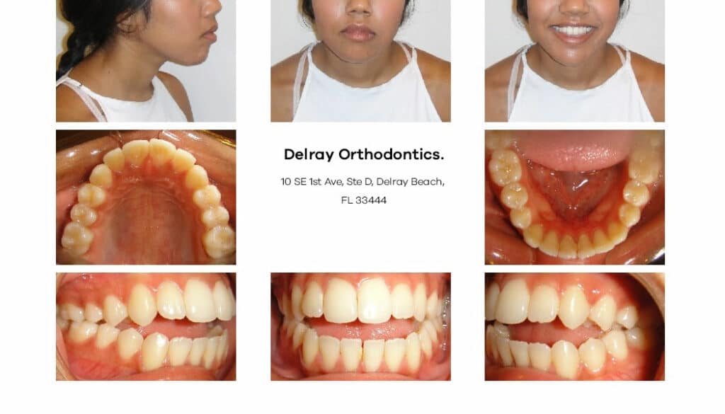 Delray Orthodontics Dental