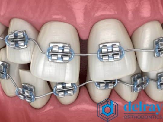 Orthodontist Delray