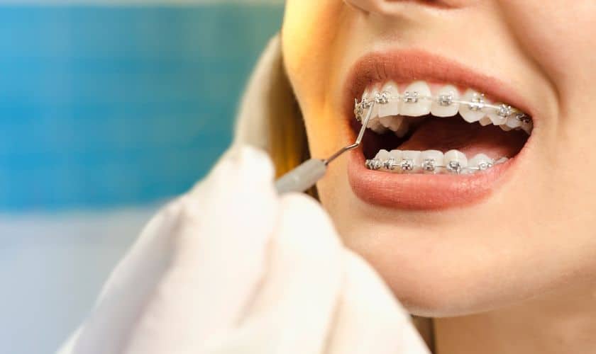 Orthodontist in Delray Beach