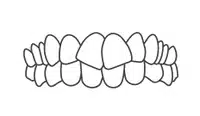 Frontal view of aligned upper and lower teeth showing ideal orthodontic treatment results.