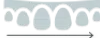 Dental arch illustration showing teeth alignment with directional arrow indicating orthodontic movement.